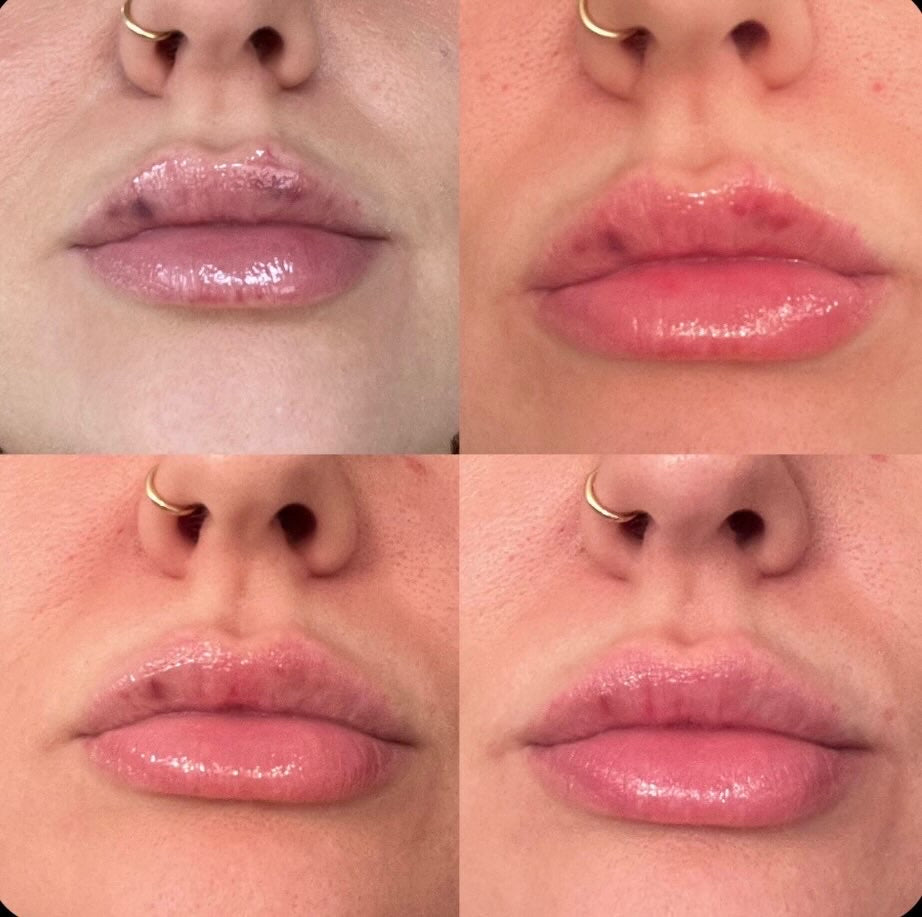 Lip Candy (Arnica Healing Gloss)